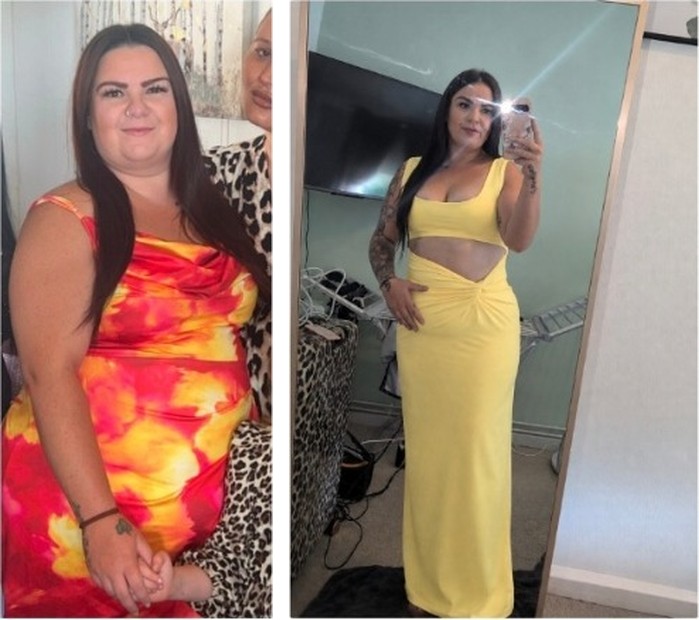 Before and after weight loss journey