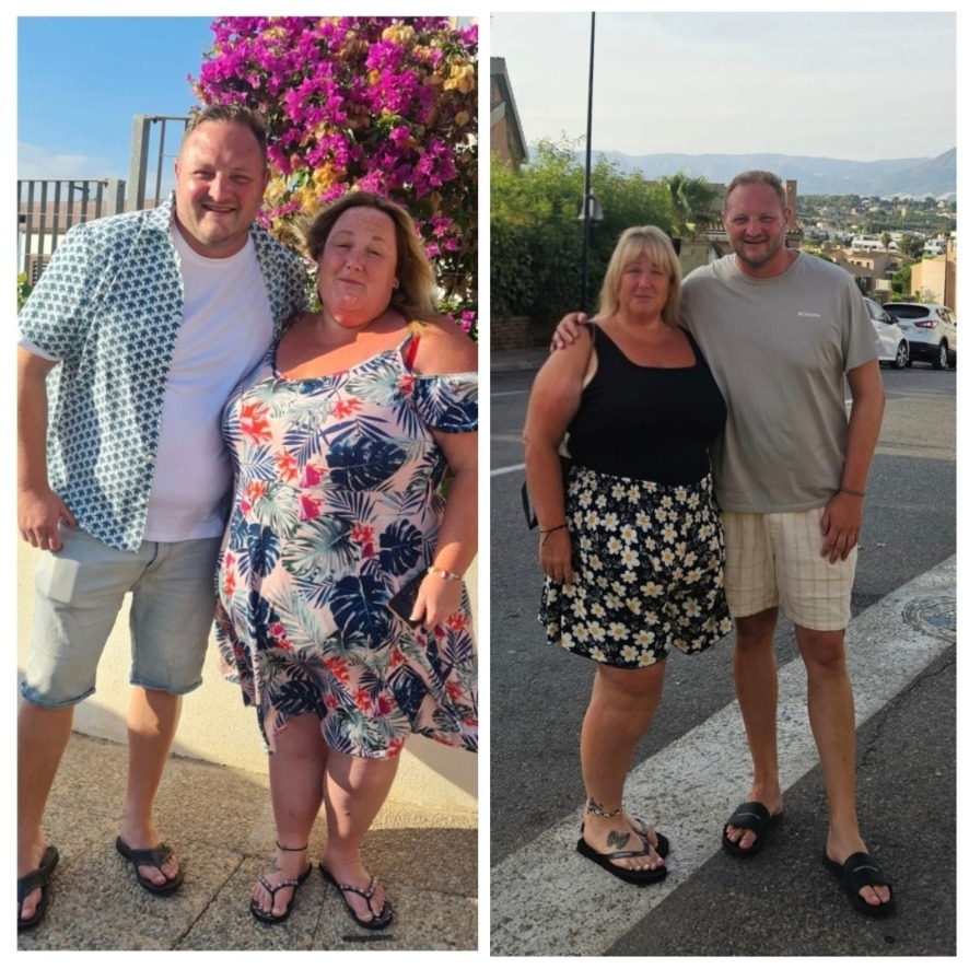 Before and after weight loss journey