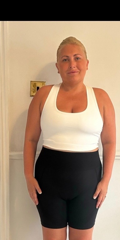 Client before beginning a Prestige weight loss programme